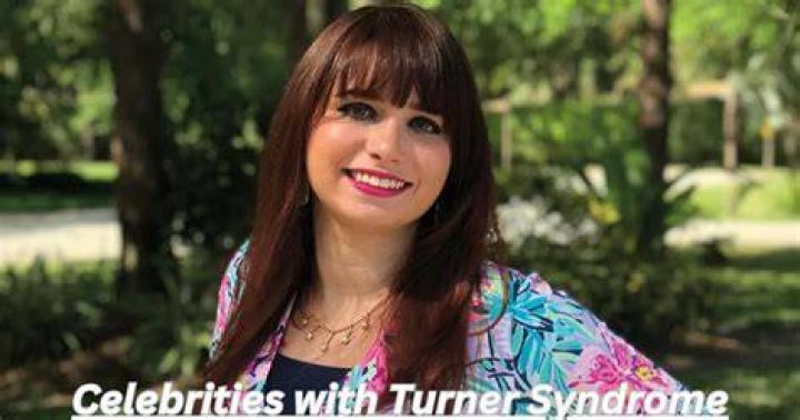 Breaking Barriers: Celebrities With Turner Syndrome