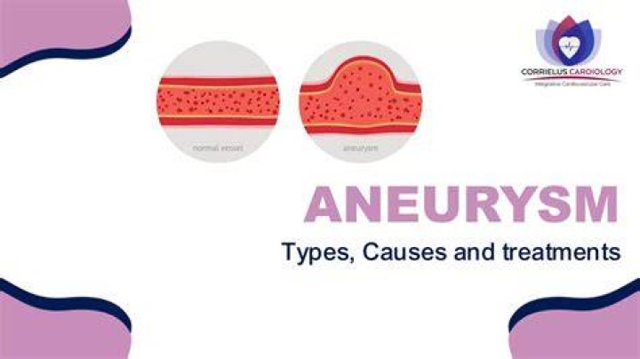 What causes an aneurysm? Jo Lindner cause of death and symptoms